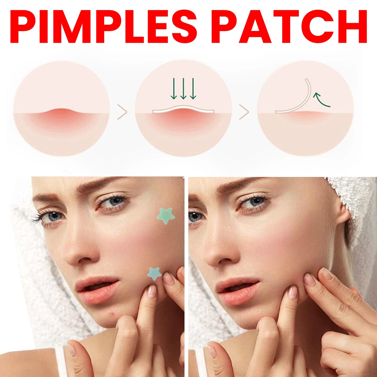 200pcs Repair Acne Patches Fade Acne Marks Red Seal Cover Blemishes Spots Remove Pimples Invisible Acne Removal Skincare Patches