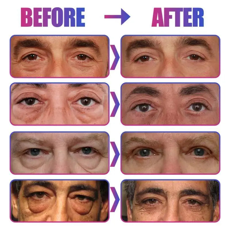 Collagen Eye Mask Wrinkle Remove Eyes Patches Firming Lifting Fade Fine Lines Hyaluronic Acid Moisturizing Smooth Eye Skin Care