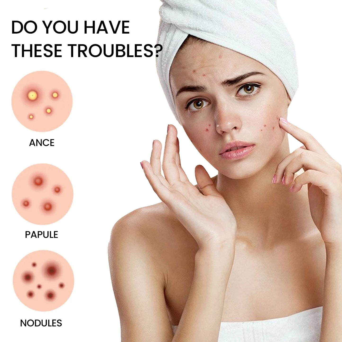200pcs Repair Acne Patches Fade Acne Marks Red Seal Cover Blemishes Spots Remove Pimples Invisible Acne Removal Skincare Patches