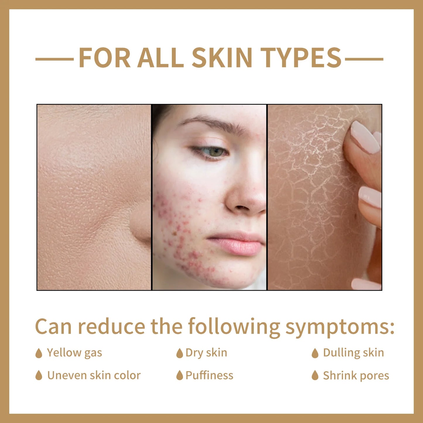 EELHOE Rice Toner for Face Brightening Serum Oil Control Moisturizing Facial Smooth Sensitive Skin Care Pore Shrinking Essence